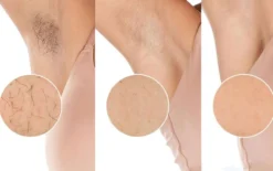 Philips Lumea IPL 8000 Series BRI946/00 karvanpoistolaite